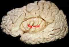 Insula you smoke it!